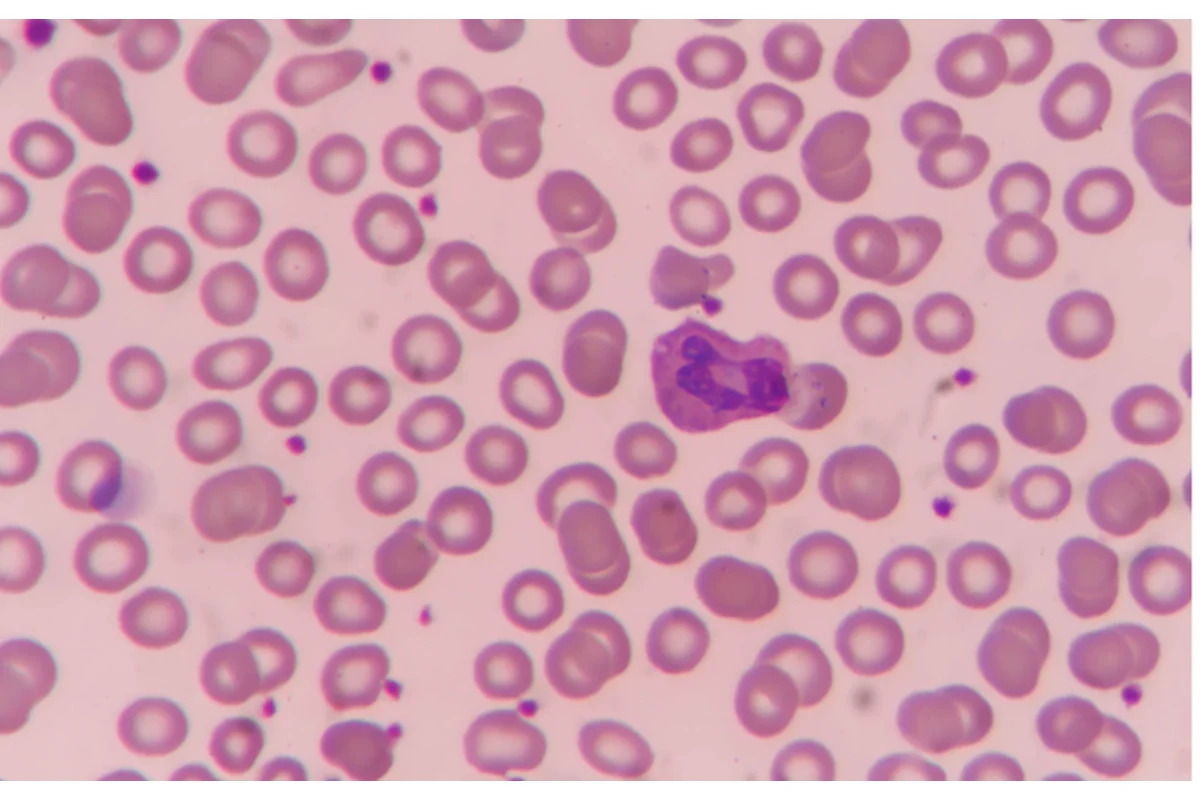 Anemia en animales de compañía